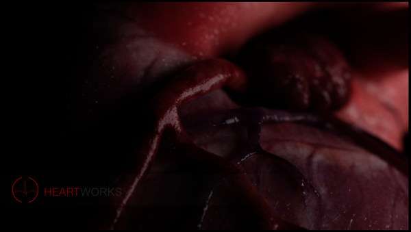 Simulation-coeur_HeartWorks1