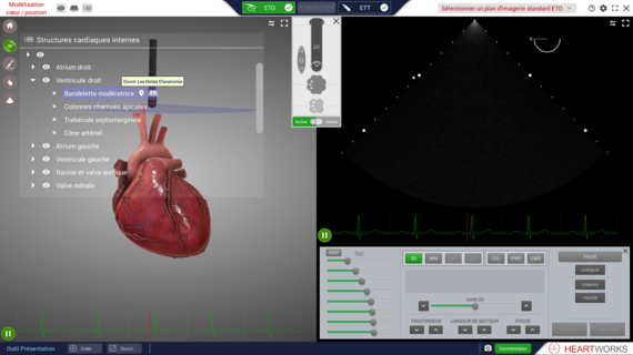 Interface_Structures-cardiaques-internes_HeartWorks