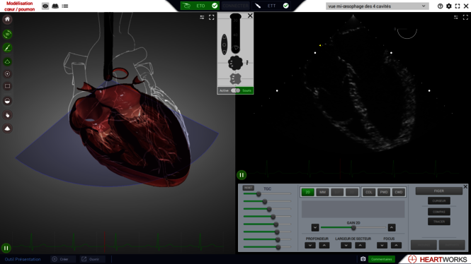 Interface_Modelisation-coeur_HeartWorks