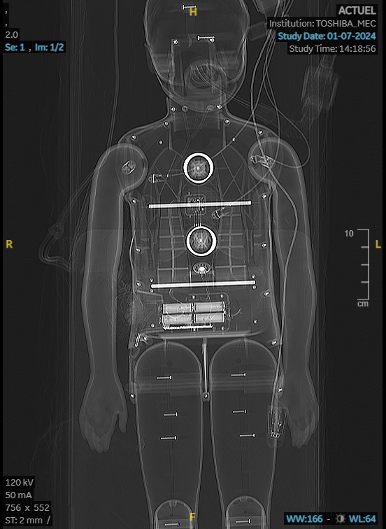 Imagerie sur mannequin pédiatrique : vue de l'image de face